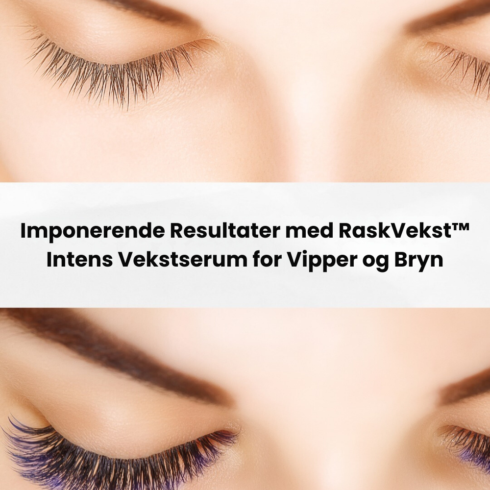 RaskVekst™ Intens Vekstserum for Vipper og Bryn