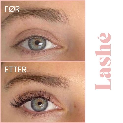 Lashé™ Vippeserum